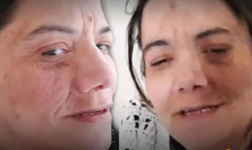 Damak Ağrısı Diye Gitti Yanlış Tedavi Yüzünden Hayatı Karardı