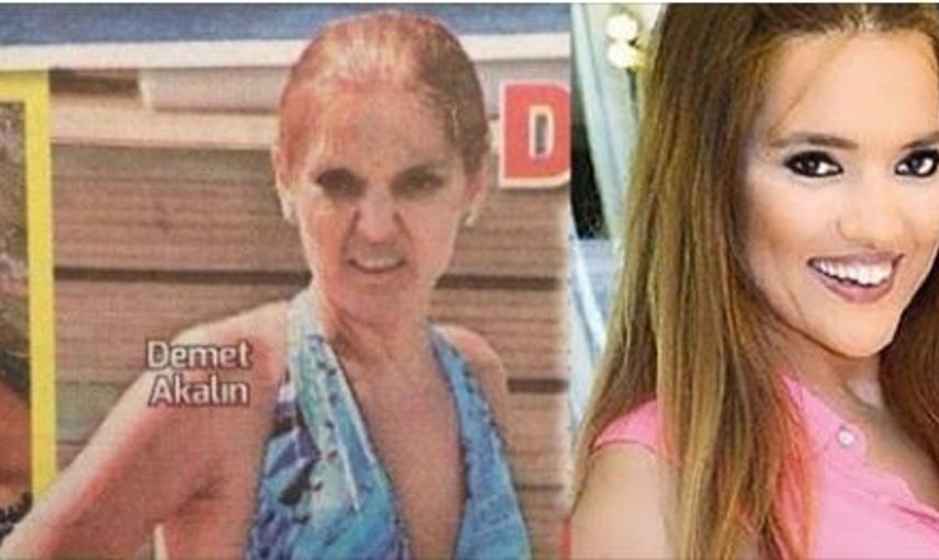 Ünlü İsimlerin 'Nefes Alsın Yeter' Diyenleri Bile Hayattan Soğutan 15 Makyajsız Fotoğrafı