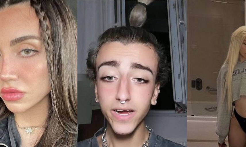 Estetik yaptırdı