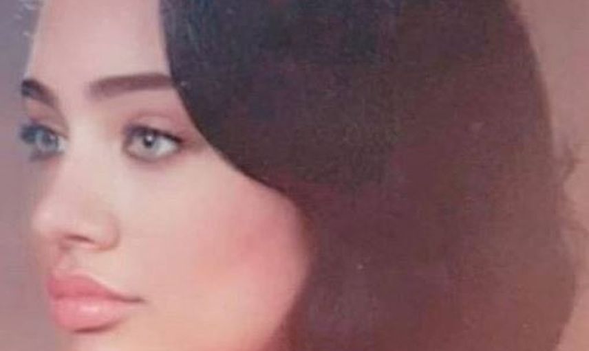 Angelina Jolie'ye Benzemek için Türlü Estetikler Yaptıran Umut Akyürek'in Parmak Isırtan Pozlar