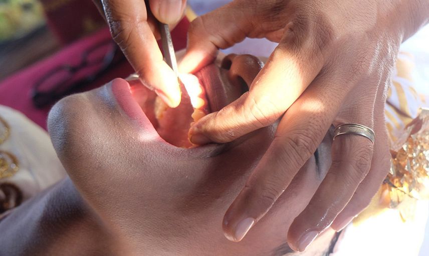 Bali’de korkutan gelenek: Cennete gitmek için dişlerini törpületmek zorundalar
