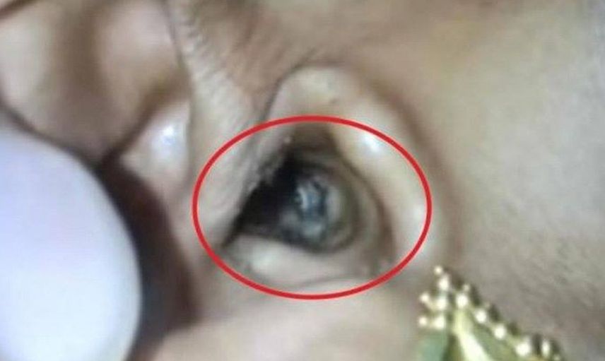 Doktor kadının kulağından çıkan şeyi görünce kendini kaybetti