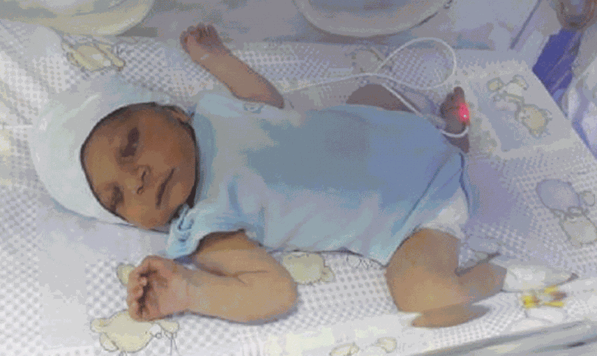 Özel Hastanede Doğum Sırasında Düşürülen Azra Bebek Yaşam Savaşı Veriyor