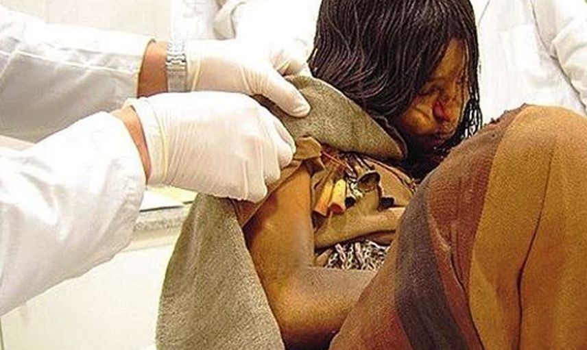 Öldükten sonra vücudumuzda meydana gelecek 15 tuhaf değişim