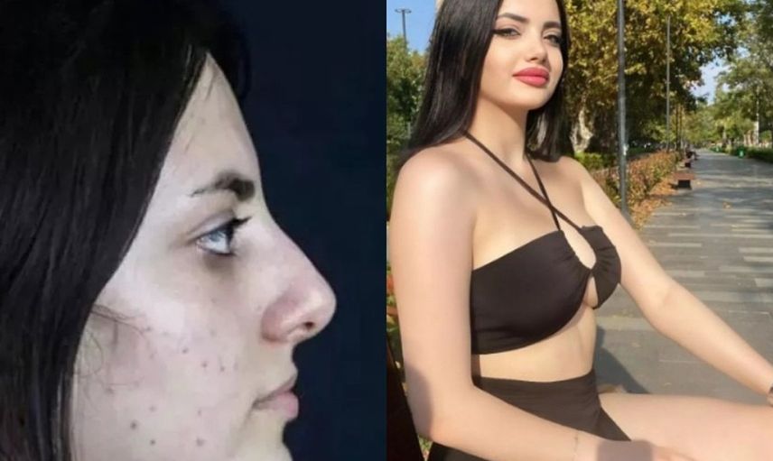 Kısmetse Olur Elif Nur Yel ifşa oldu! O görüntüleri herkesi şoke etti