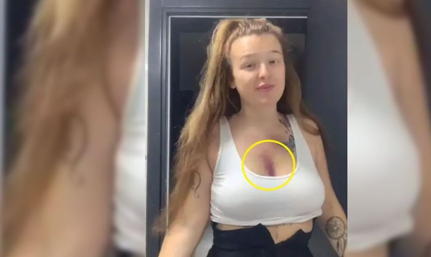 Estetik kurbanı olan kadın kendini tanıyamaz hale geldi
