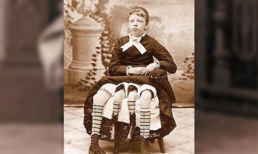 Dört bacak ve iki rahimle doğan kadın Myrtle Corbin'nin hayat hikayesi