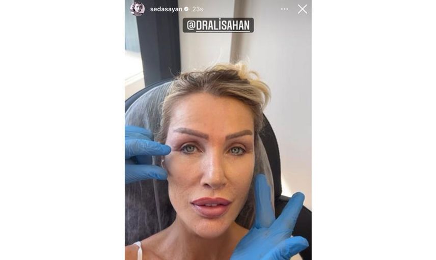 Seda Sayan ölümden döndü: Genç kocasına güzel görünmek için estetik yaptırdı, yüzü tanınmaz hale geldi