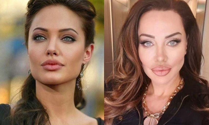 Angelina Jolie'ye Benzemek için Türlü Estetikler Yaptıran Umut Akyürek'in Parmak Isırtan Pozlar