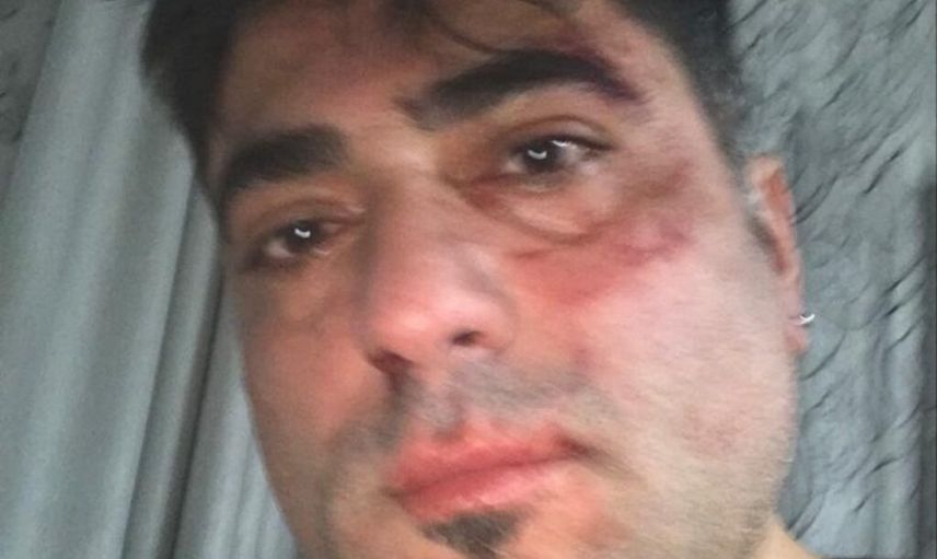 İzmir’de Kadın Eşinin Gözlerini Oymaya Çalıştı