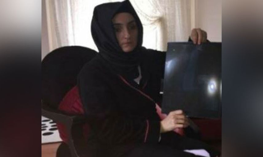 Ağrıların normal dediler eve gönderdiler Meğer hastanın karnında mala unutmuşlar!
