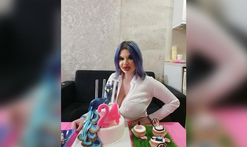 Dünyanın En Büyük Dudaklı Kadını