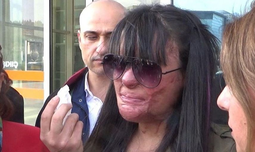 Yüzünü Yakan Kişiyle Evlenen Berfin Özek’in Babası Konuştu