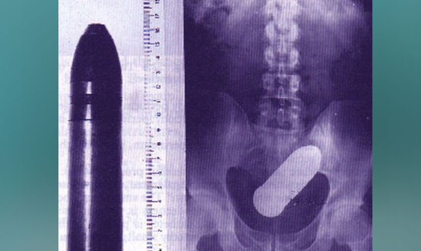 Türlü sex oyuncakları yüzünden sonu hastanelik olan insanlar