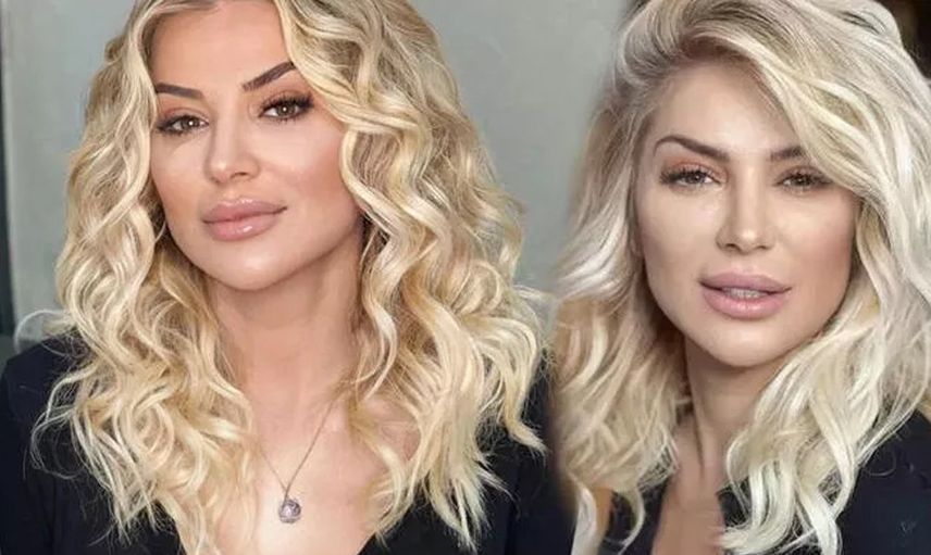 Songül Karlı'nın yeni hali ortaya çıktı! Bıçak altına yatan ünlü oyuncu bakın kime benzetildi