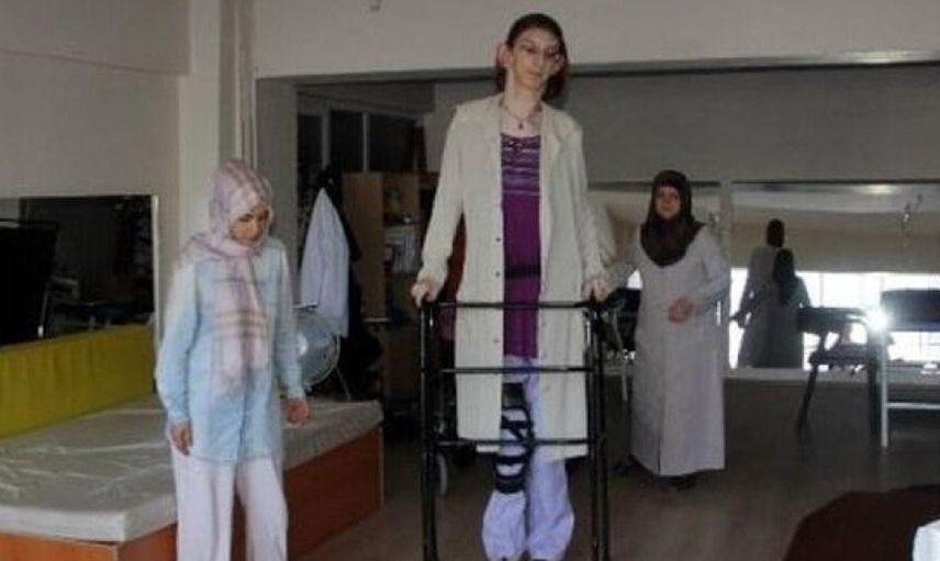Dünyanın en uzun kadını Rümeysa 3. kez rekorlar kitabına girdi!
