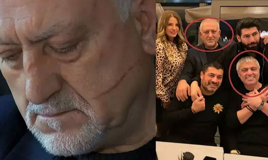Cengiz Kurtoğlu tanımadığı birini darp etmişti: Cezası belli oldu