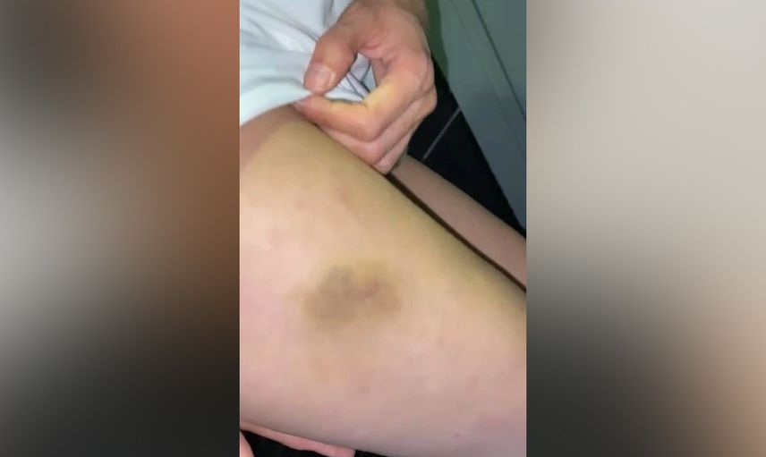 Survivor Yunus Emre sevgilisine dehşeti yaşattı! Yasaklı madde kullanıp sevgilisini dövdü: 'Uyuşturucu madde kullanır'