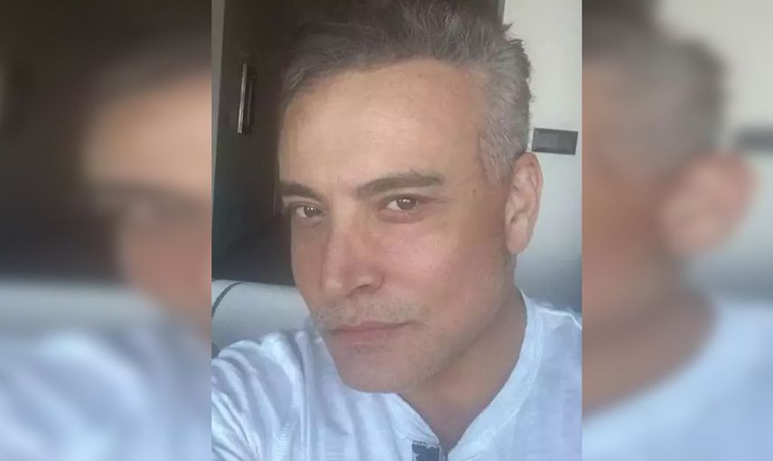 Cenk Eren yüz gerdirme ameliyatı oldu! Son hali herkesi şoke etti!