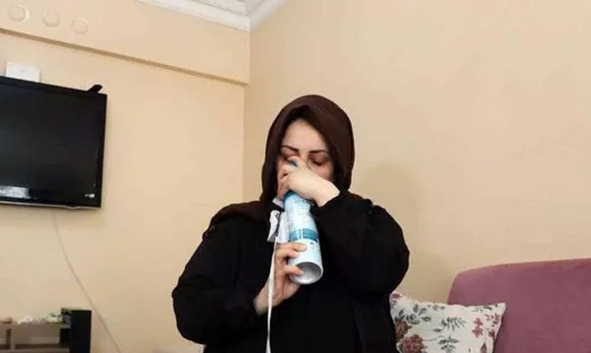 Sakarya'da ilginç bir vaka! Elleri ayakları bir anda morarıyor hastalığının adı bile yok