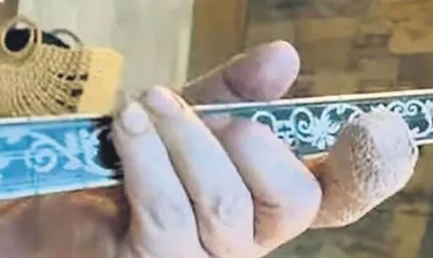 Cüneyt Arkın'dan sonra şimdi de Orhan Gencebay! Ünlü şarkıcı apar topar hastaneye kaldırıldı sevenlerini yıkan haber geldi!