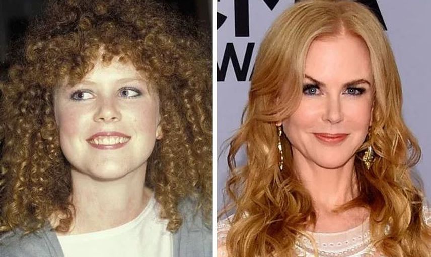 Nicole Kidman
