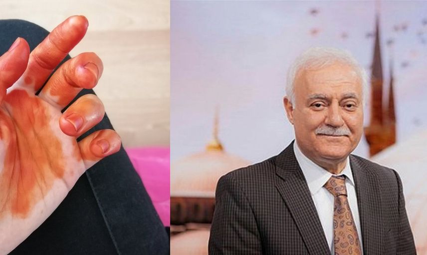 Uykudan uyandı elinde kına olduğunu gördü! Meğerse uyanınca elde kına görmek cinlerle ilgiliymiş