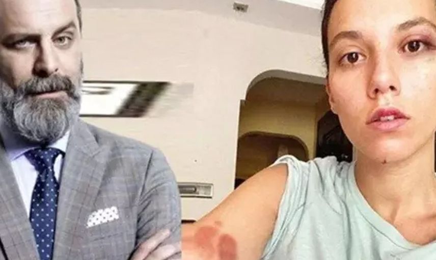 Ozan Güven'in eski sevgilisi Deniz Bulutsuz'u darp ettiği davada son gelişme: Adli Tıp Kurumu raporu hazırladı