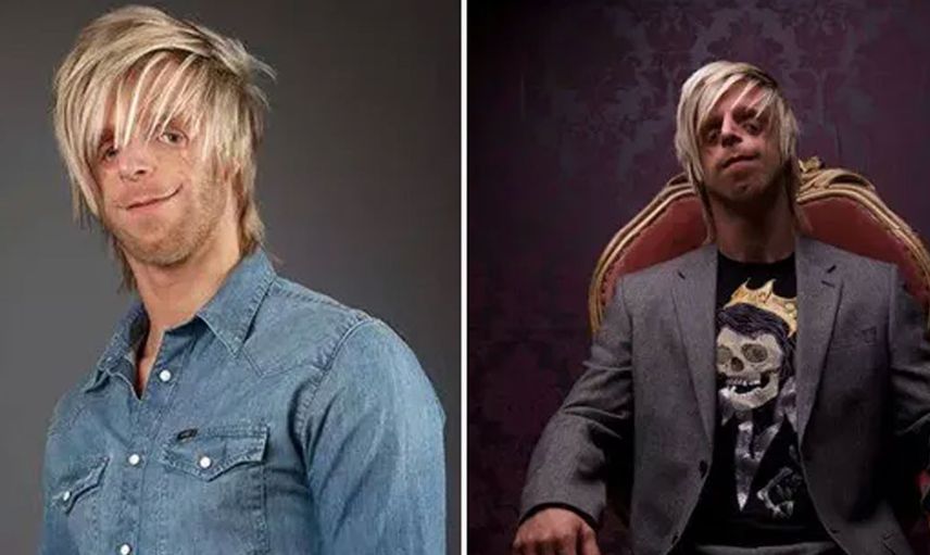 Yeni doğan bebeklerinin yüzünü görünce hastaneden kaçtılar: Jono Lancaster'ın hikayesi herkesi duygulandırdı