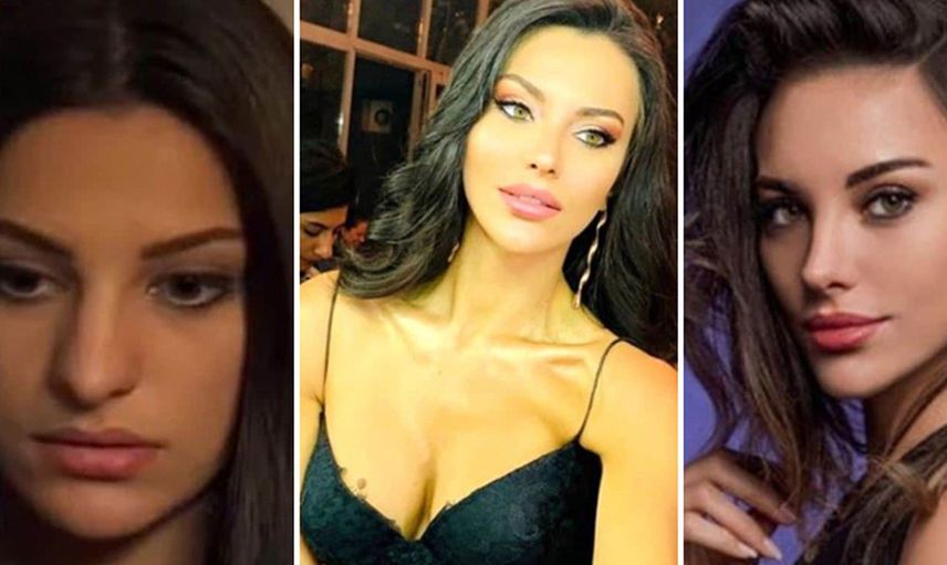 Ünlü oyuncu Tuvana Türkay estetik güzeli çıktı! Estetiksiz halini görenler inanamadı: Ülkeyi terk ederim!