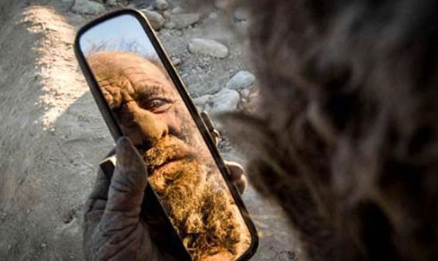 İran'da yaşayan şahıs 65 yıldır suya dokunmuyor