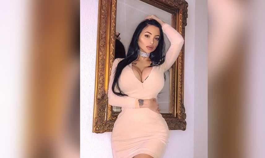 Çirkin diye alay edilmesine dayanamadı bıçak altına yattı