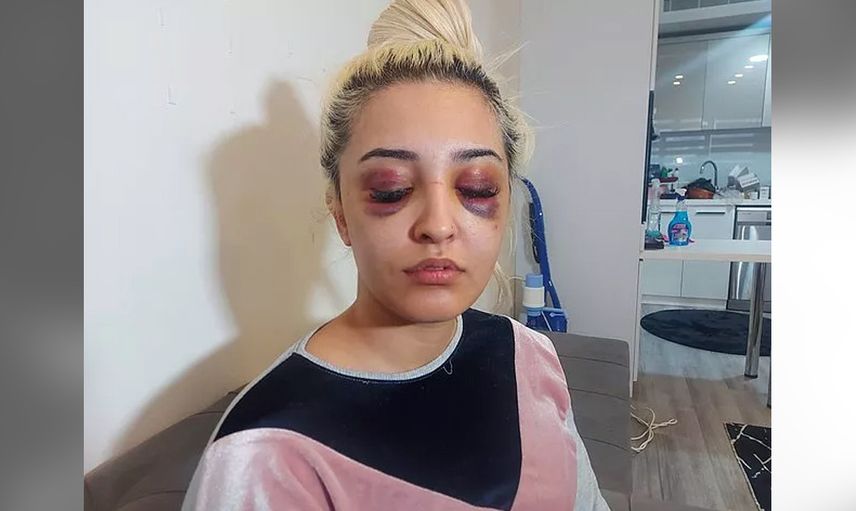 İzmir’de korkunç olay! Gamze Tümtürk’ün sevgilisi önce dövdü sonra uyumak istedi