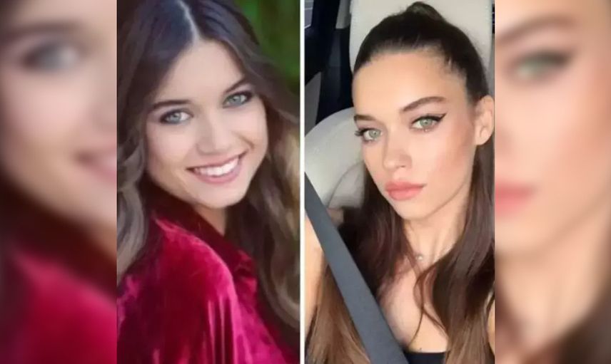 Doğal değilmiş! Afra Saraçoğlu'nun estetiksiz hali ifşa oldu