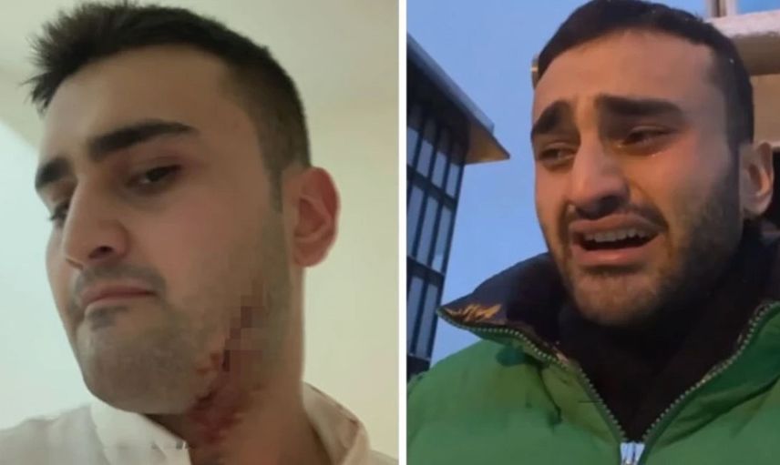 Kan revan içindeki halleri korkutmuştu: CZN Burak'tan açıklama geldi!