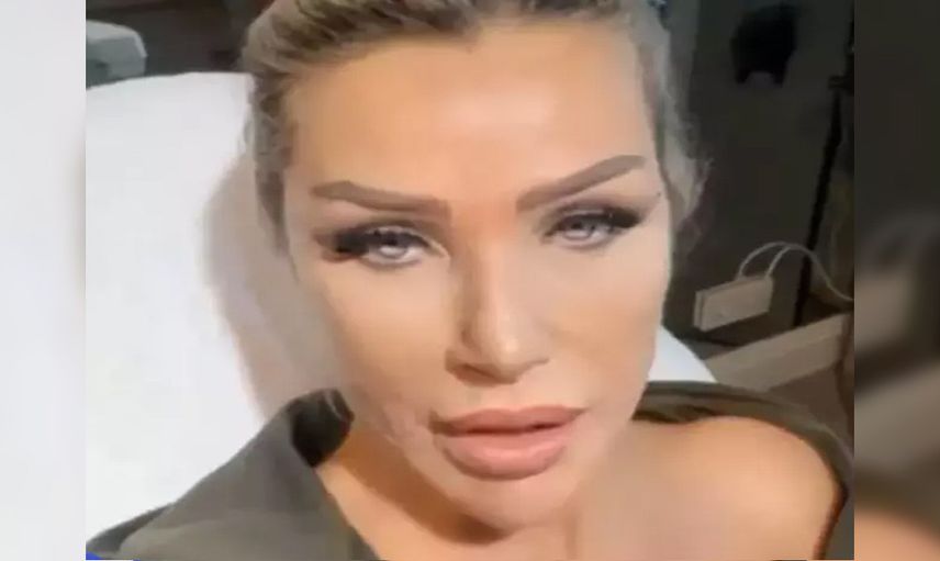 Yüzüne sünnet derisi enjekte etmişti! Seda Sayan'ı öyle bir isim aradı ki: Ben de istiyorum!