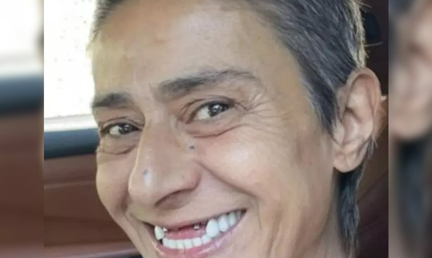 Yıldız Tilbe'den şoke eden poz: Dişsiz halini paylaştı, hayranlarını korkuttu!