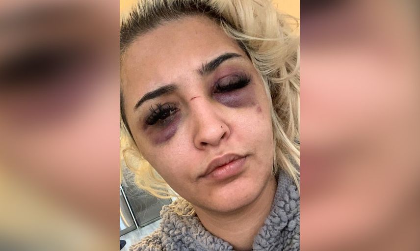 İzmir’de korkunç olay! Gamze Tümtürk’ün sevgilisi önce dövdü sonra uyumak istedi