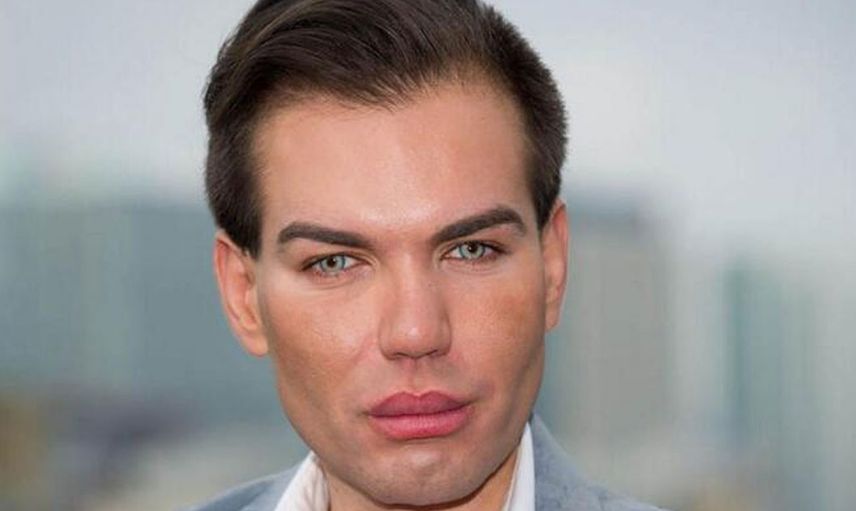 Barbie'nin sevgilisi Ken bebeğe benzemek için ameliyat olan Rodrigo Alves