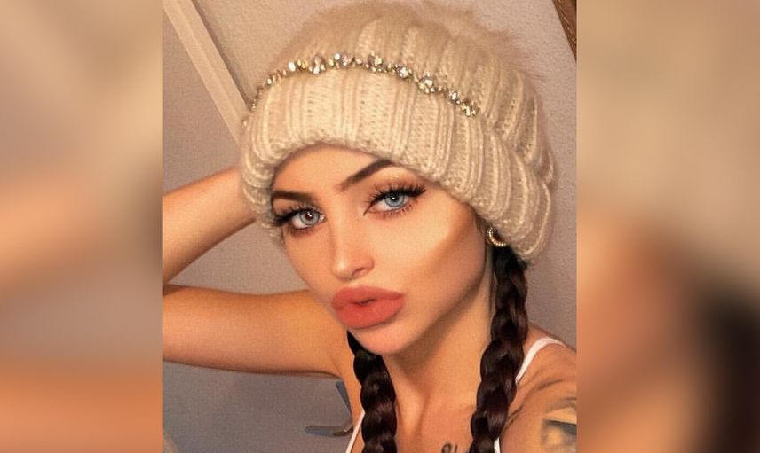 Çirkin diye alay edilmesine dayanamadı bıçak altına yattı