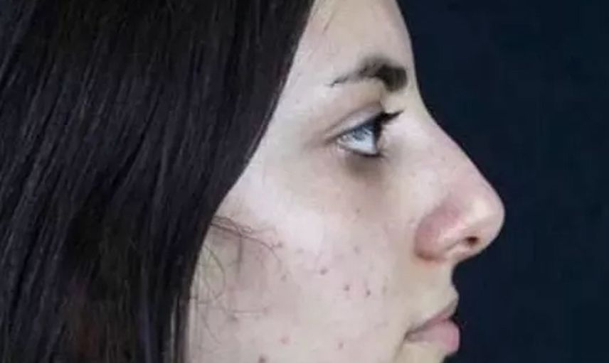 Kısmetse Olur Elif Nur Yel ifşa oldu! O görüntüleri herkesi şoke etti