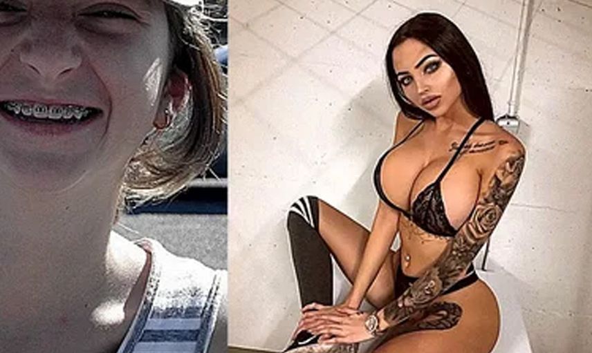 Çirkin diye alay edilmesine dayanamadı bıçak altına yattı