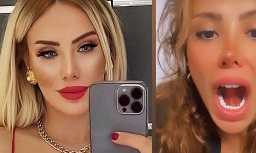 Ceyda Ersoy, öpüşürken kopan dilini diktirdi o videosu olay oldu