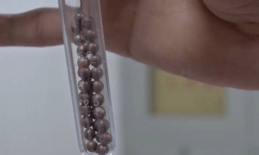 14 yaşındaki çocuk erkeklik organına 53 tane manyetik top soktu
