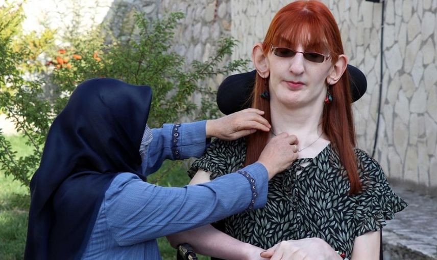 Dünyanın en uzun kadını Rümeysa 3. kez rekorlar kitabına girdi!