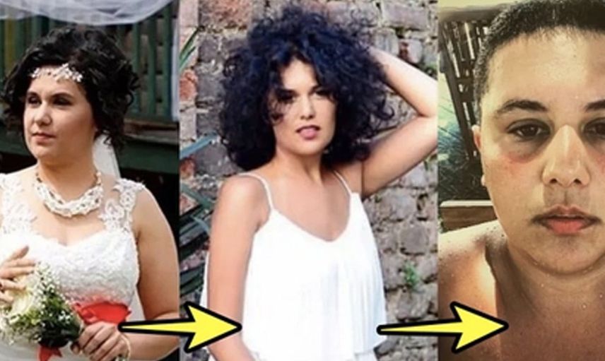 Cinsiyet değiştirmişti! Atlas Karan Tumluer'in son hali olay oldu