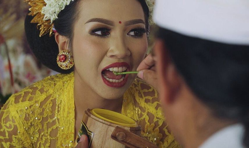 Bali’de korkutan gelenek: Cennete gitmek için dişlerini törpületmek zorundalar