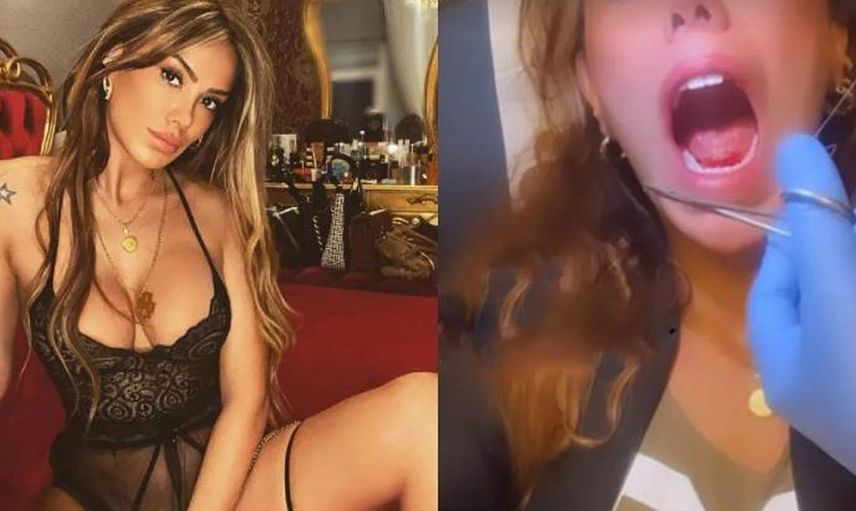 Ceyda Ersoy, öpüşürken kopan dilini diktirdi o videosu olay oldu