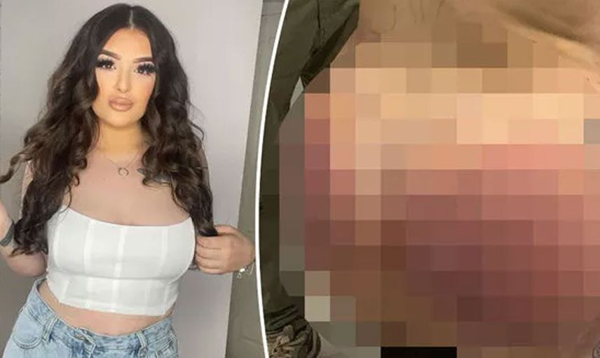 Estetik kurbanı olan kadın kendini tanıyamaz hale geldi
