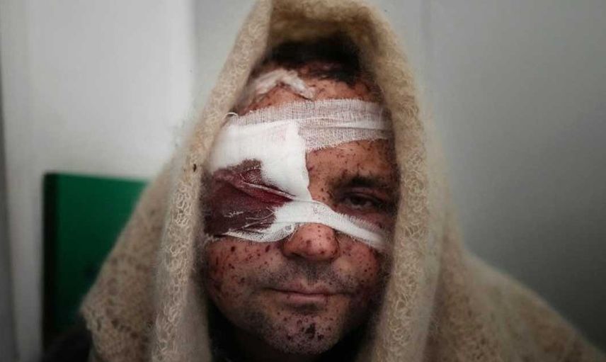 Rusya bir aydır Kiev'e giremedi
